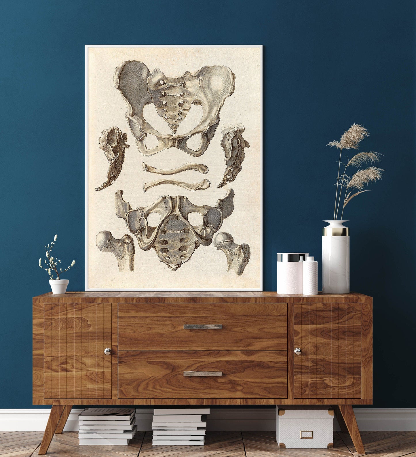 Bekken Anatomieposter – Orthopedische Illustratie